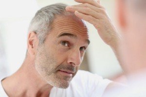 Почему выпадают волосы на голове у мужчин?